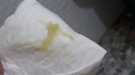 ảnh chụp màn hình bong nút nhầy bao lâu thì chuyển dạ