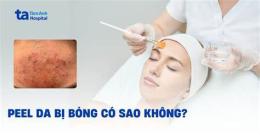 ảnh chụp màn hình peel da bị bỏng phải làm sao