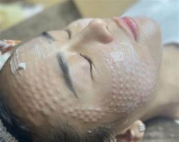 ảnh chụp màn hình tiêm meso căng bóng da giá bao nhiêu