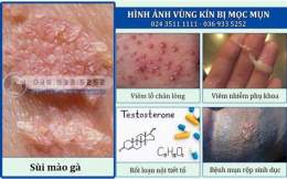 ảnh chụp màn hình vùng kín bị khô bong da có sao không