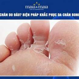bị bong da chân là thiếu chất gì