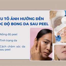 bong da sau peel