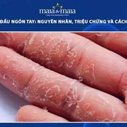 bong tróc da đầu
