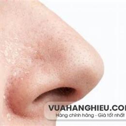 cánh mũi bị khô bong da