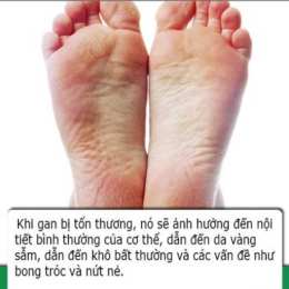 da bàn chân bị bong tróc là bệnh gì