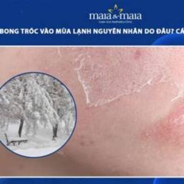 da bị khô bong tróc vào mùa đông