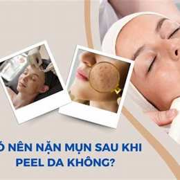 da đang bong sau peel nên làm gì