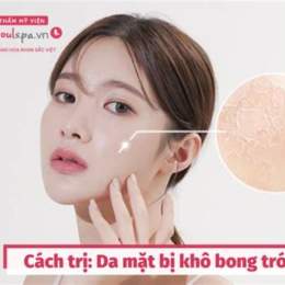 da mặt bong tróc