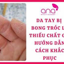 da tay bị bong