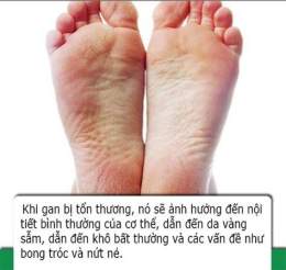 giao diện app bàn chân bị bong tróc da
