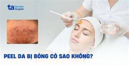 giao diện app peel da bị bỏng nhẹ