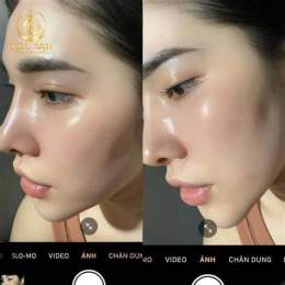 giao diện app tiêm căng bóng da mặt giá bao nhiêu