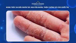 giao diện app trẻ bị bong tróc da đầu ngón chân