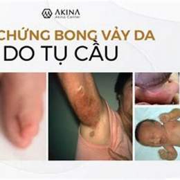 hội chứng bong vảy da do tụ cầu