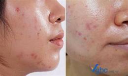 hướng dẫn sử dụng da bóng dầu