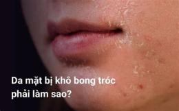 hướng dẫn sử dụng da mặt khô bong tróc nên dùng gì tại nhà