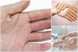 hướng dẫn sử dụng da tay chân khô bong tróc