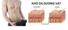 hướng dẫn sử dụng dương vật bị khô và bong da