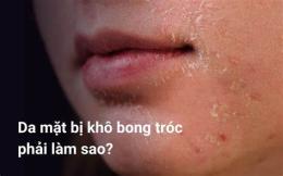 hướng dẫn sử dụng mặt bị bong da phải làm sao