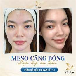 hướng dẫn sử dụng meso căng bóng da