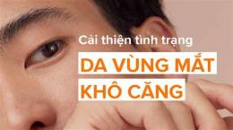 hướng dẫn sử dụng mí mắt bị khô bong da