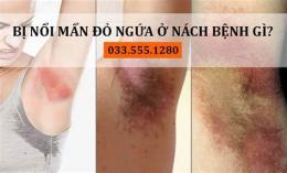 hướng dẫn sử dụng nách bị ngứa và bong da