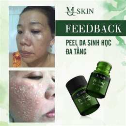 hướng dẫn sử dụng peel bong da