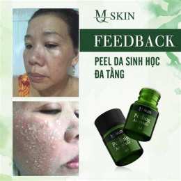 hướng dẫn sử dụng peel da bong