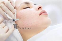 hướng dẫn sử dụng tiêm meso căng bóng da giá bao nhiêu