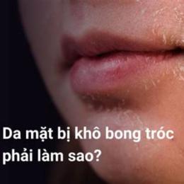 mặt bị bong da phải làm sao
