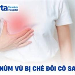 núm vú bị ngứa và bong da