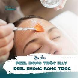 peel da không bong tróc loại nào tốt