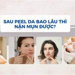 peel da sau bao lâu thì bong