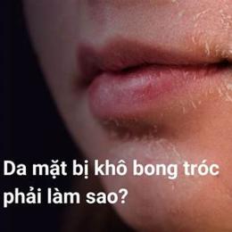 tại sao da mặt bị bong tróc
