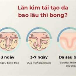 tái tạo da bao lâu thì bong