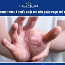 tay bong da là thiếu chất gì