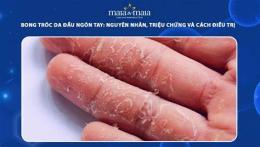 tính năng nổi bật bé bị bong da đầu ngón tay
