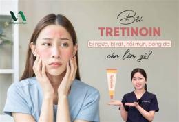 tính năng nổi bật bôi tretinoin bị bong da trong bao lâu