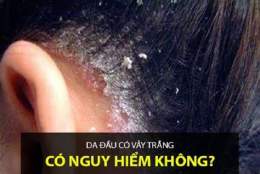 tính năng nổi bật bong da đầu