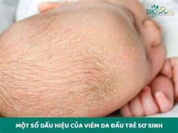 tính năng nổi bật bong da ở trẻ sơ sinh