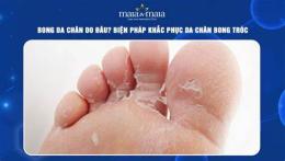 tính năng nổi bật da chân bong tróc