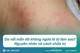 tính năng nổi bật da mặt khô, ngứa mẩn đỏ bong tróc