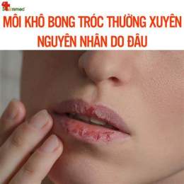 tính năng nổi bật da quanh miệng bị khô bong tróc