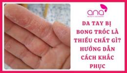 tính năng nổi bật da tay bị bong là thiếu chất gì