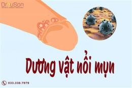 tính năng nổi bật dương vật bị bong da