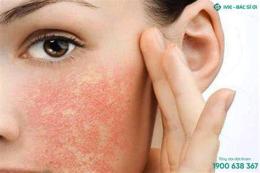 tính năng nổi bật mặt bị bong da phải làm sao