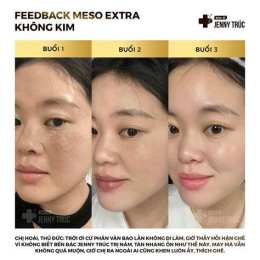 tính năng nổi bật meso căng bóng da