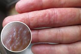 tính năng nổi bật nổi bóng nước trên da