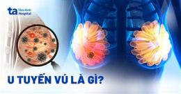 tính năng nổi bật núm vú bị ngứa và bong da