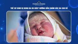 tính năng nổi bật trẻ sơ sinh bị bong da có sao không